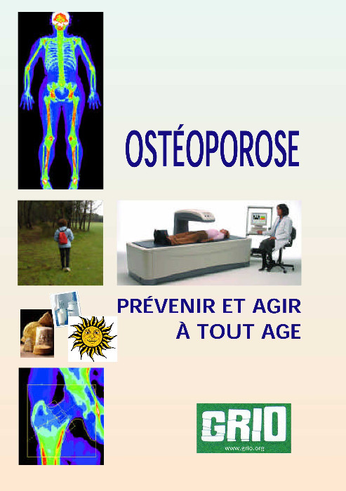 Ostéoporose, prévenir et agir à tout âge